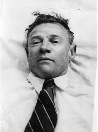 Полицейская фотография «Человека из Сомертона», восстановленная в 1948 году. Эту реконструкцию австралийская полиция распространила по всем дентальным архивам мира — без результата.